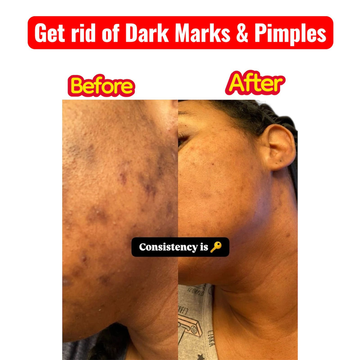 Korean Radiance 5-Step Set