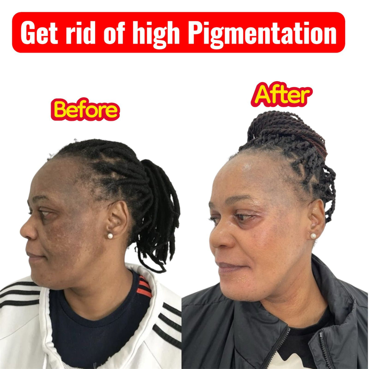 Korean Radiance 5-Step Set