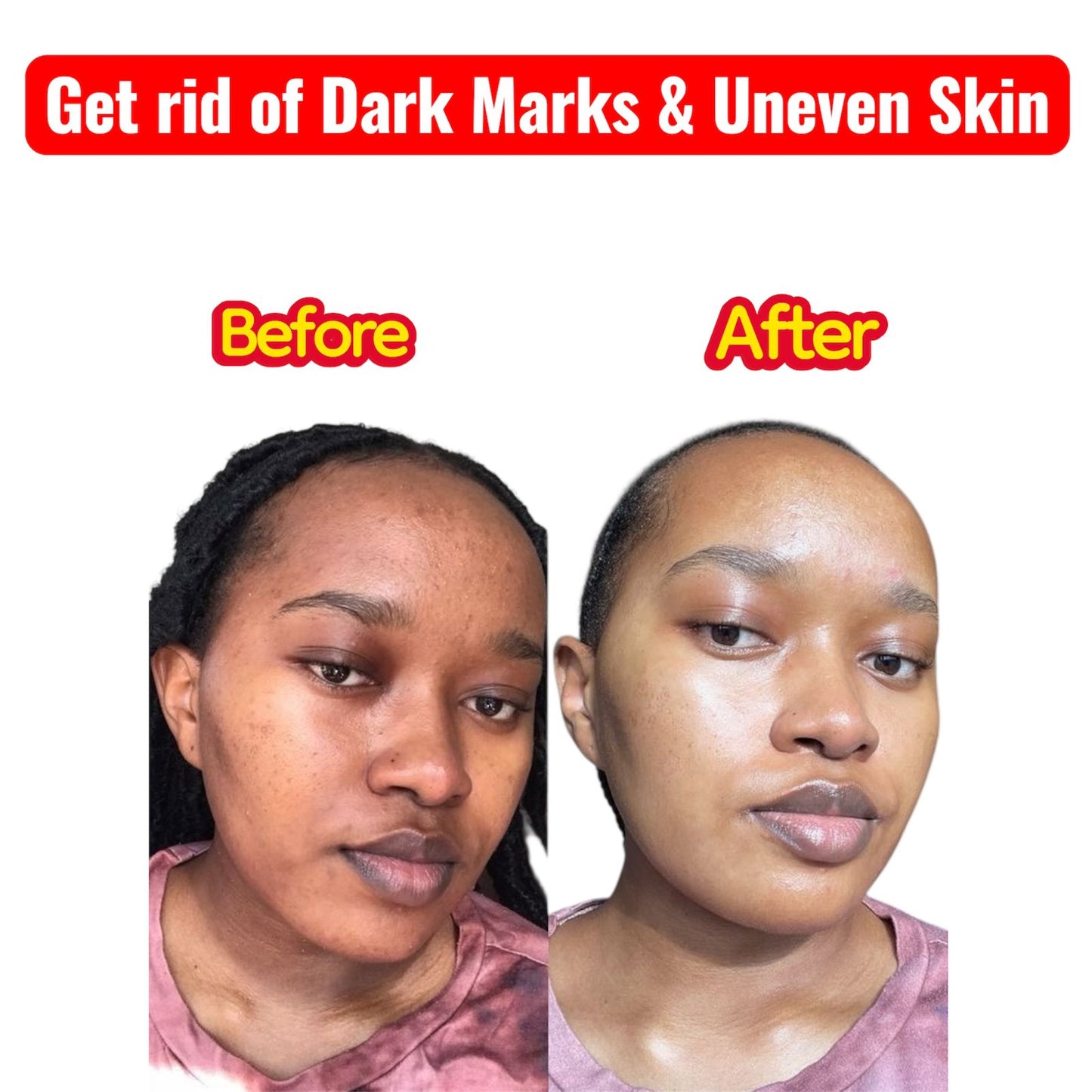 Korean Radiance 5-Step Set