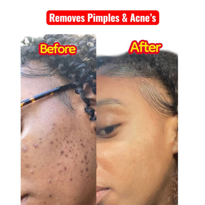 Korean Radiance 5-Step Set